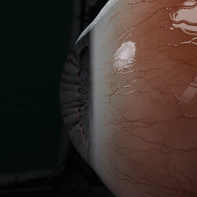 cornea_ref_issue2.jpg