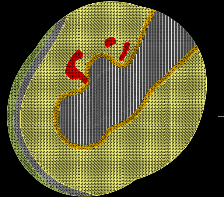 Offset normal to Surface - Autodesk Community