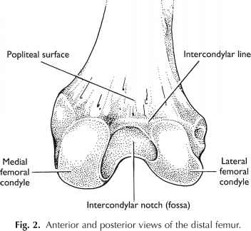 Intercondylar Notch Femur