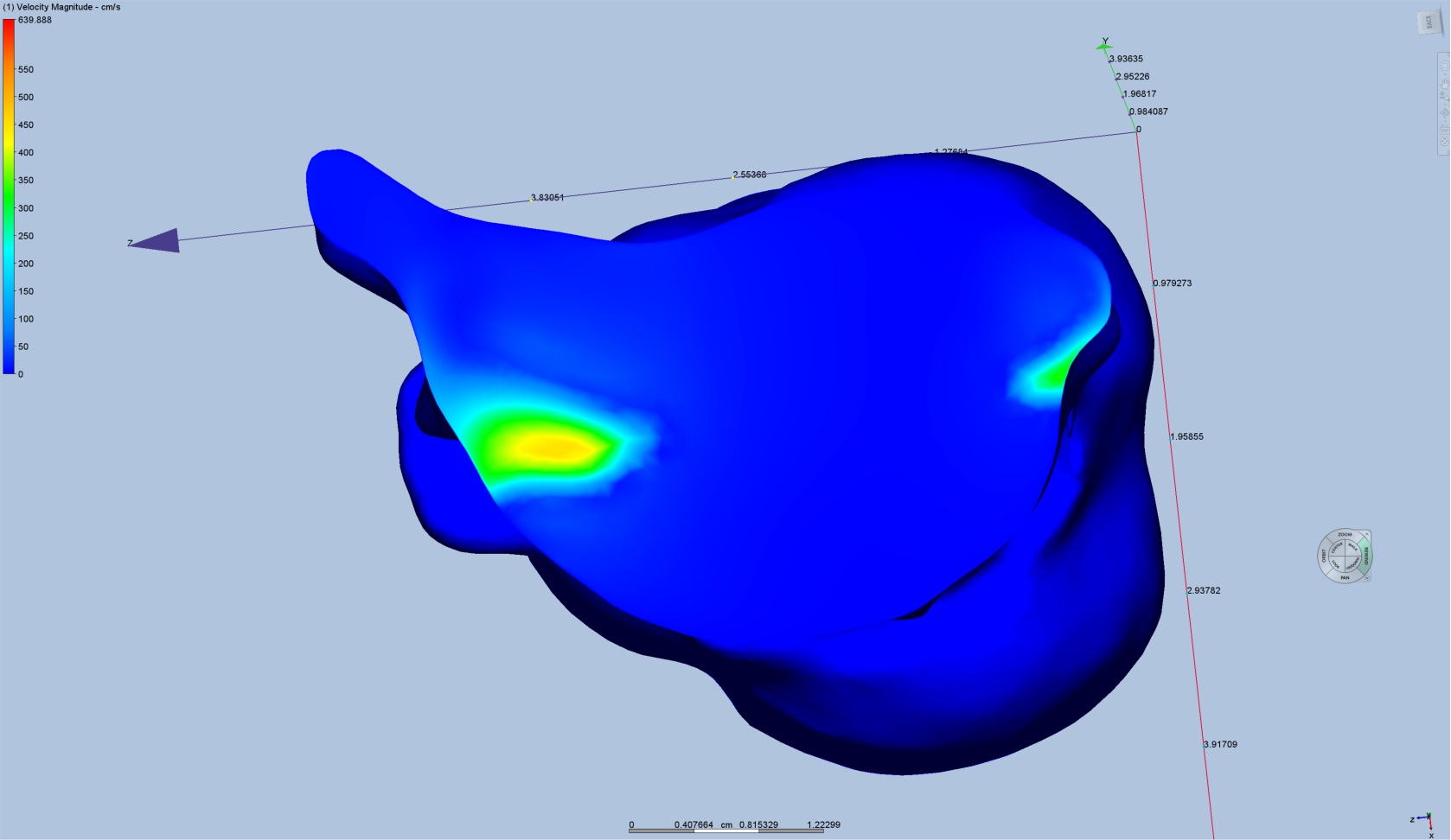 Solved: Solver Becomes Unstable in Transient Analysis - Autodesk Community